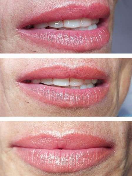 Micropigmentación de labios en Sanxenxo