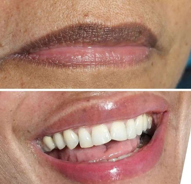 Micropigmentación de labios Sanxenxo